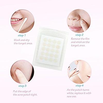 Natural Acne Spot Stickers Hydrocolloid Absorbing Acne Pimple Patch