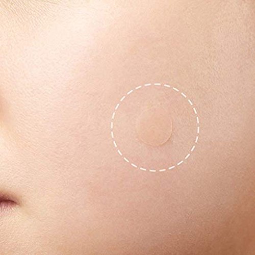 Hydrocolloid Instant Acne Pimple Patch Cover Tree Waterproof Acne Patch