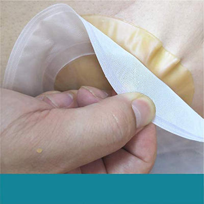 2020 One Piece Ostomy Bags With Closure For Colostomy Hydrocolloid Ostomy Bags