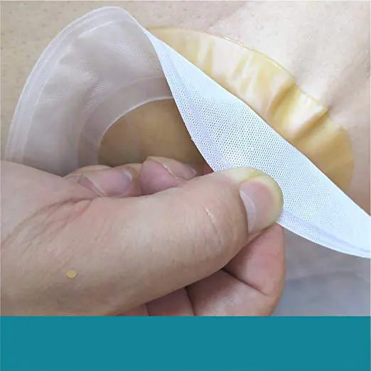 One Piece Ostomy Pouching System Drainable Ostomy Pouch